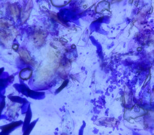 Imagen 6B.﻿ Citología con cinta adhesiva de todas las superficies afectadas. Se aprecia una gran cantidad de levaduras (﻿Malassezia﻿ spp.; >40 por campo de 400x), principalmente en la región interdigital de las extremidades posteriores