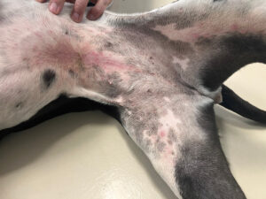 Imagen 1B.﻿ Eritema axilar (B) moderado, con pápulas aisladas.﻿