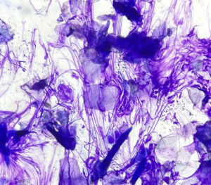 Imagen 6C.﻿ Citología con cinta adhesiva de todas las superficies afectadas. En las extremidades anteriores se observa una gran cantidad de material nuclear de polimorfonucleares neutrófilos con bacterias