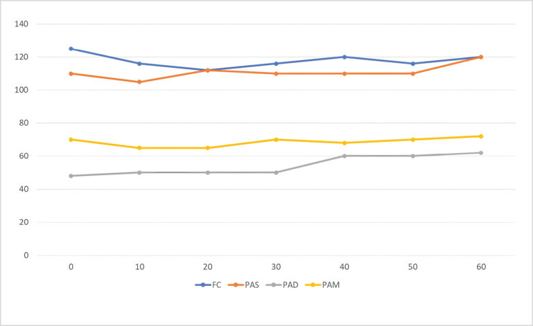 Evolución de la frecuencia cardiaca y las presiones arteriales sistólica, diastólica y media durante la anestesia.