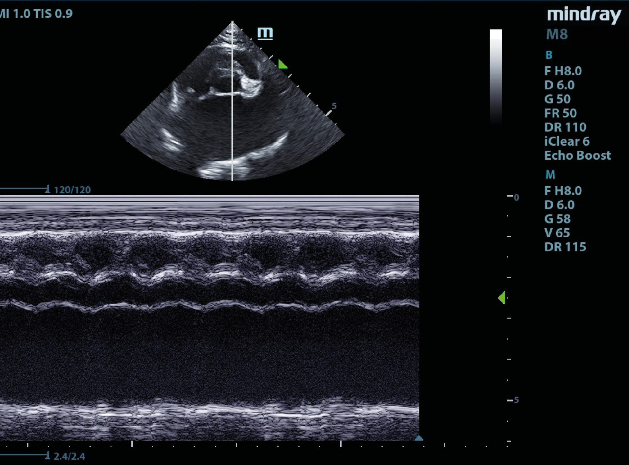 Modo M ecocardiográfico en la vista paraesternal derecha, eje corto, a la altura de la aorta y atrio izquierdo de un paciente felino con CMH. Se puede observar una disminución en la contractilidad del atrio izquierdo.