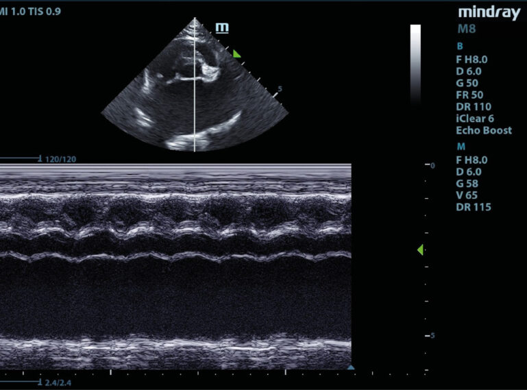 Modo M ecocardiográfico en la vista paraesternal derecha, eje corto, a la altura de la aorta y atrio izquierdo de un paciente felino con CMH. Se puede observar una disminución en la contractilidad del atrio izquierdo.