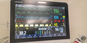 Imagen del monitor del paciente durante la anestesia