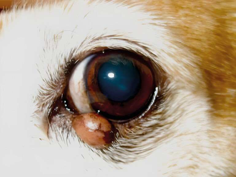 Chalación palpebral.