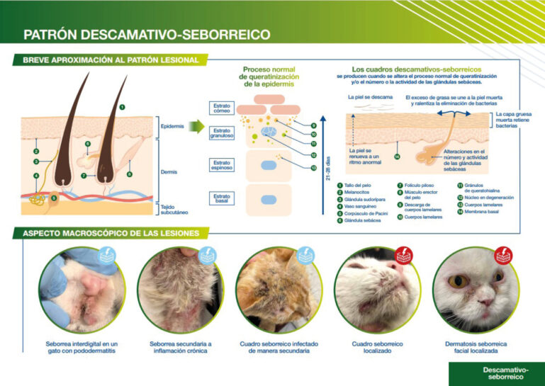 Infografía del patrón descamativo-seborreico. Aproximación al patrón lesional