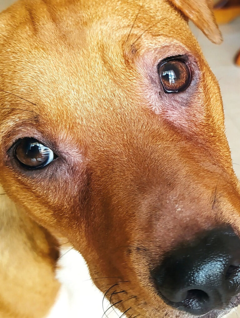 Alopecia periocular en paciente con dermatitis atópica.﻿