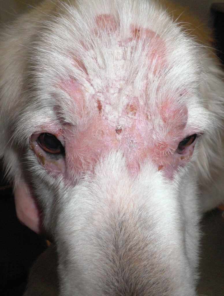 PAlopecia periocular y eritema moderado asociado a linfoma cutáneo.