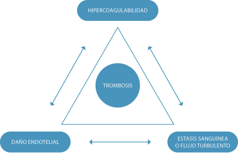 Imagen 1. Resumen de la tríada de Virchow, que incluye hipercoagulabilidad sistémica, estasis del flujo sanguíneo, turbulencia y lesión endotelial4.