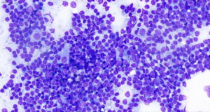 Células observadas en un análisis de leishmaniosis canina bajo microscopio.