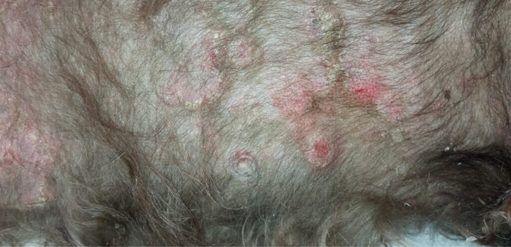 Perro con dermatitis atópica. Eritema, descamación, collaretes epidérmicos y lesiones nodulares múltiples.﻿