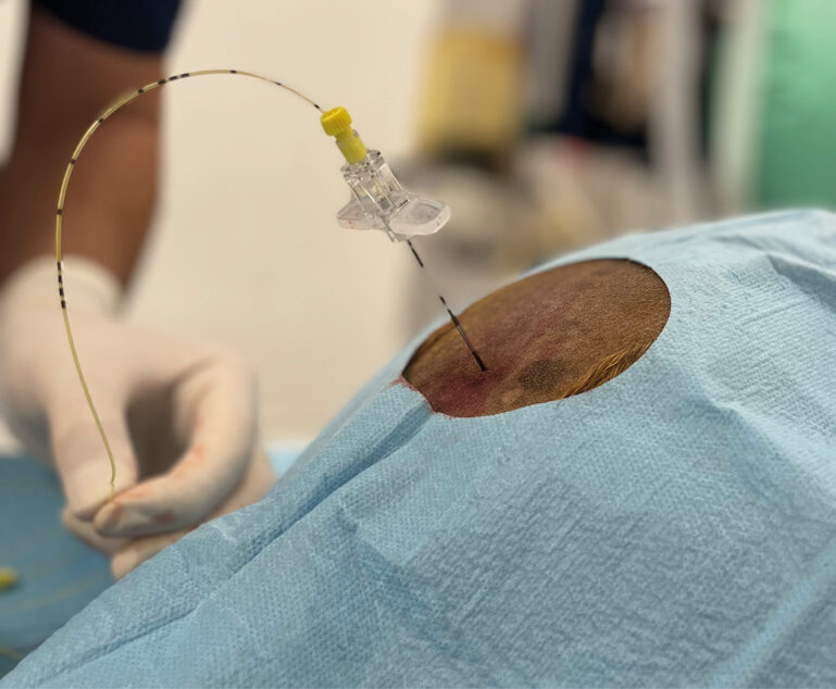 Colocación de catéter epidural en perro.