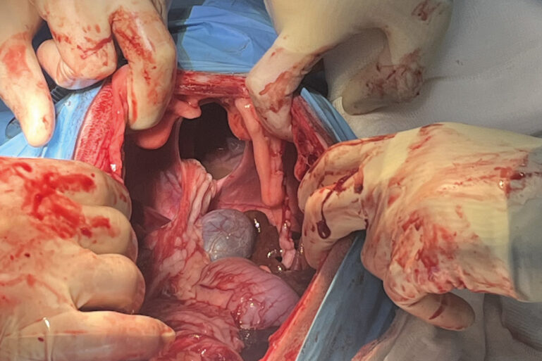 Imagen intraquirúrgica del defecto asociado a la hernia peritoneopericárdica en un perro.