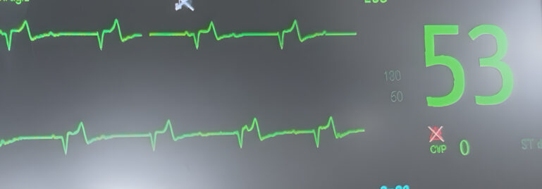 ECG derivación II. Paciente felino con potasemia 9,2 mmol/L asociada a obstrucción uretral.