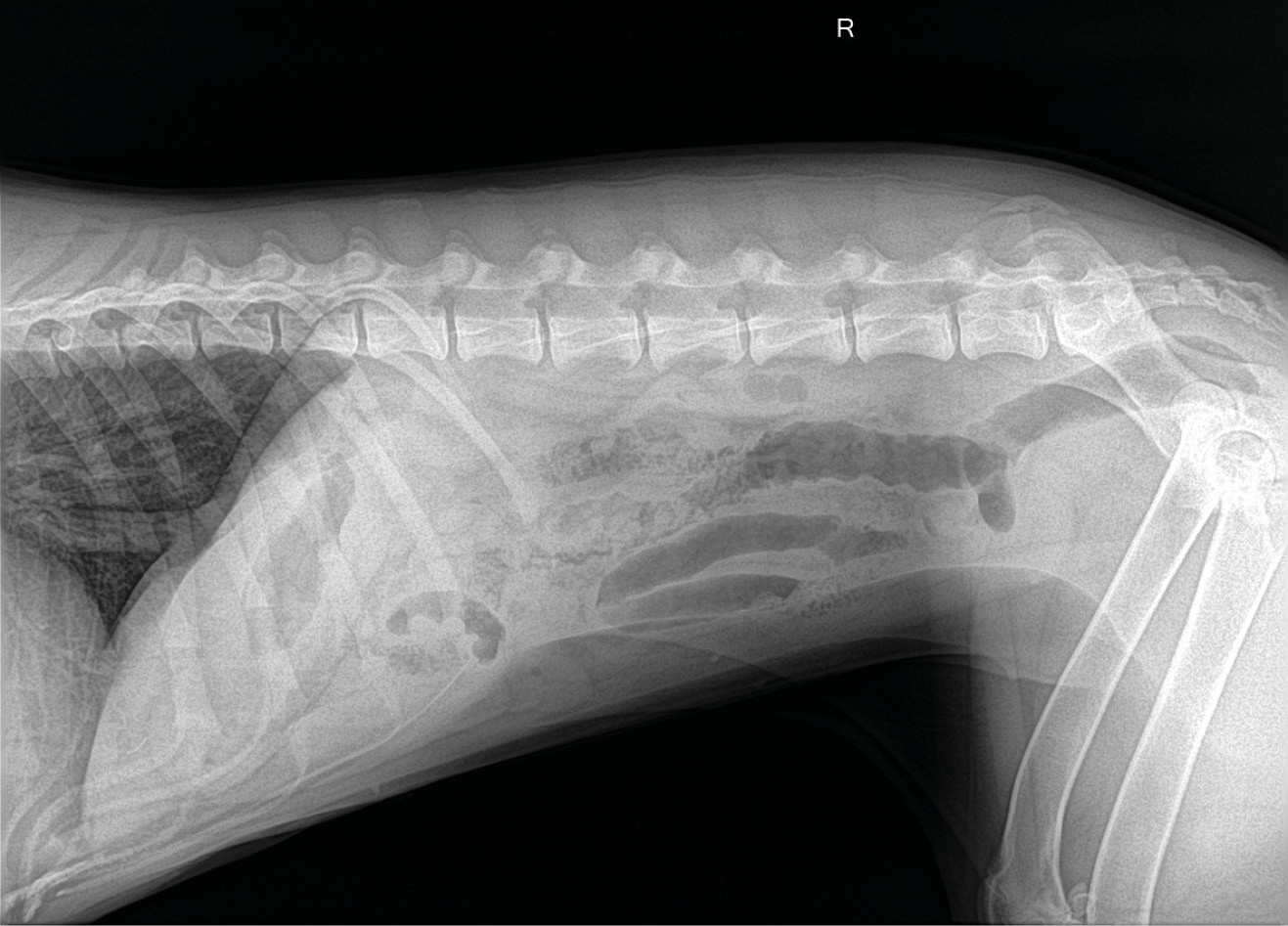 Radiografía lateral de abdomen. Imagen de “vidrio esmerilado” con pérdida del detalle seroso compatible con la presencia de líquido libre abdominal / peritonitis.