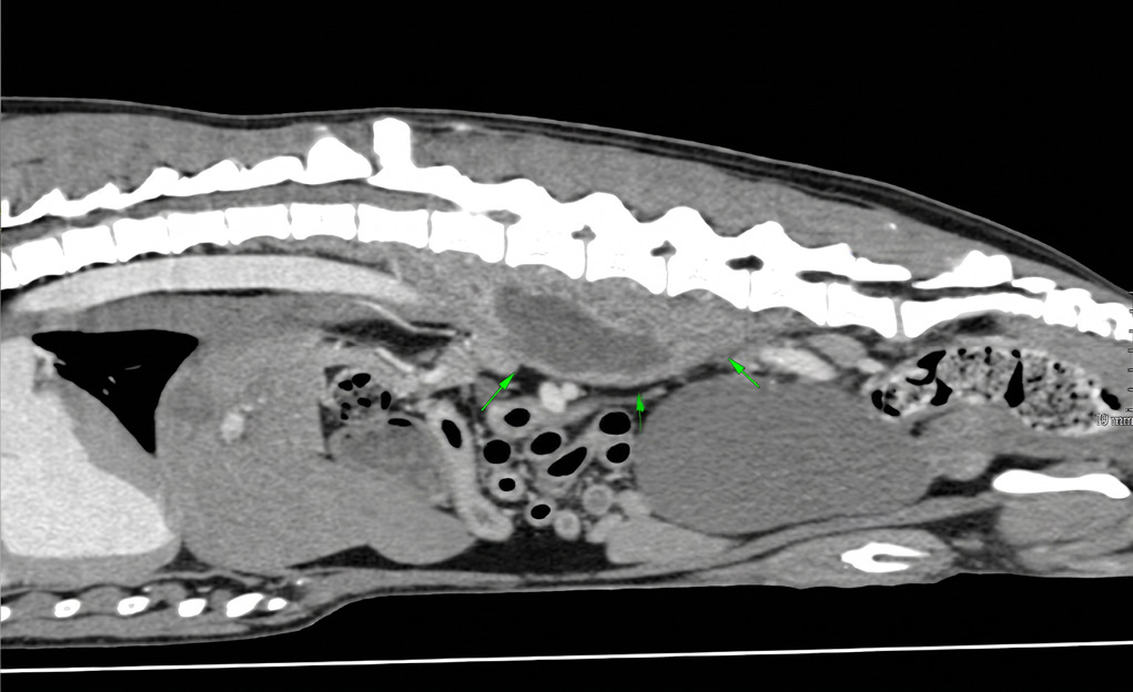 Tomografía computarizada de un perro donde se observa un acúmulo de fluido (absceso) en la musculatura sublumbar, probablemente producido por la presencia de un cuerpo extraño.