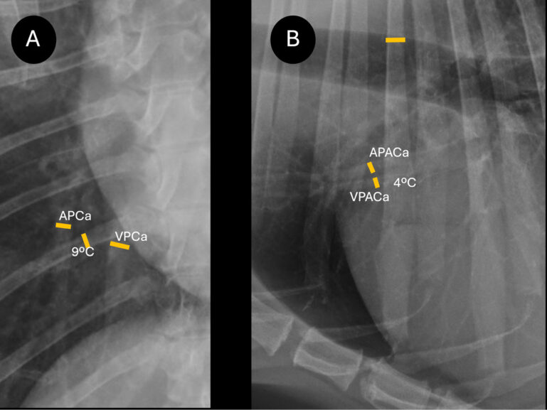 Representación de la determinación de los diámetros arteriales y venosos pulmonares y su relación con respecto a la 4ª y 9ª costillas torácicas en proyecciones dorsoventral (A) y lateral derecha (B)