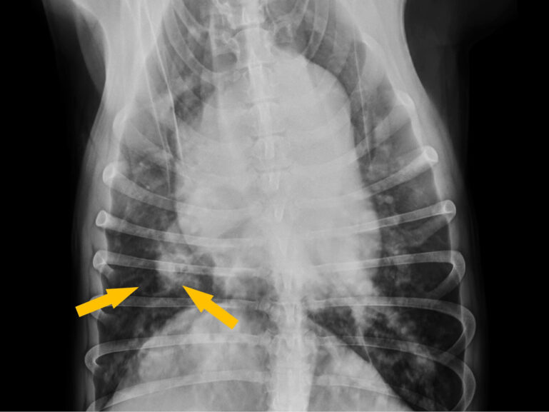 Proyección dorsoventral en la que se observa pérdida de continuidad de la arteria pulmonar caudal derecha compatible con presencia de tromboembolismo pulmonar y graves signos de hipertensión arterial pulmonar.