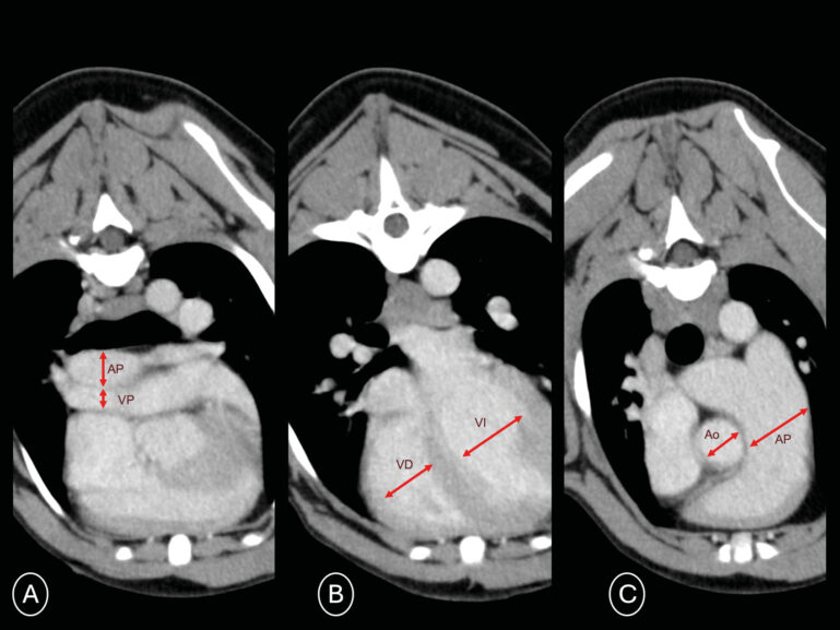 Presencia de graves signos de hipertensión pulmonar en un paciente canino parasitado por Dirofilaria immitis.