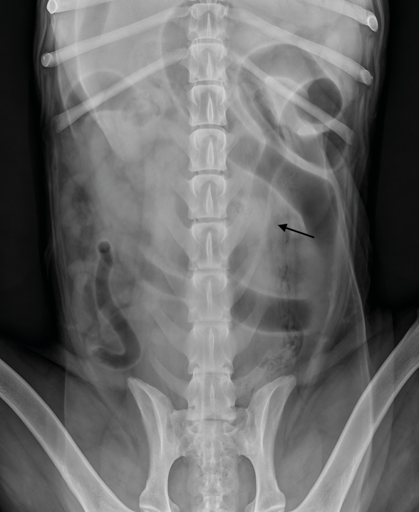 Estudio radiográfico del abdomen: Proyeccón ventrodorsal