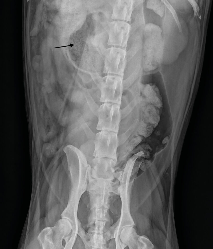 Estudio radiográfico del abdomen: proyección ventrodorsal