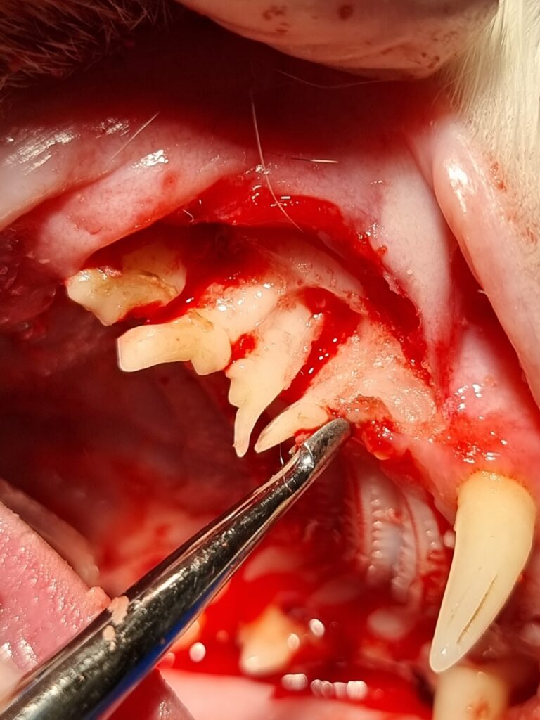 Maniobra de odontosección en una pieza multirradicular para dividirla en unidades independientes antes de la luxación.