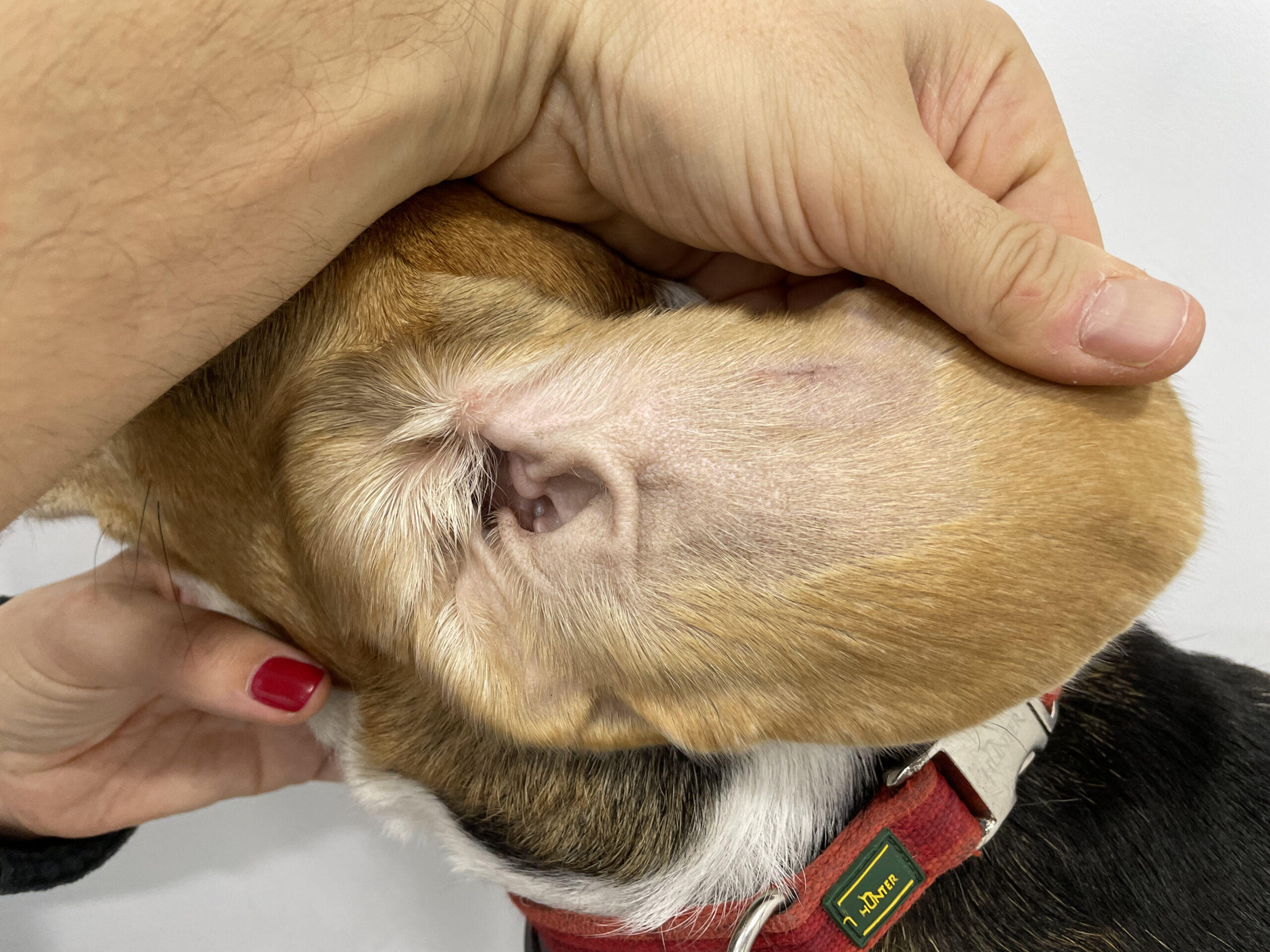 Imagen del pabellón auricular anterior izquierdo en la que se observa la cicatriz de la incisión todavía eritematosa y eritema leve en la base de la oreja.