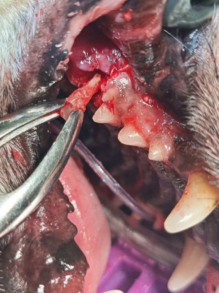 Extracción de la raíz tras haber logrado la movilidad suficiente en el espacio periodontal.