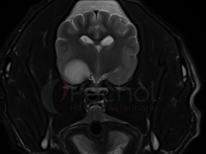 Imagen de resonancia magnética mostrando un glioma canino