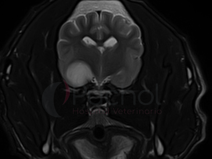 Imagen de resonancia magnética mostrando un glioma canino