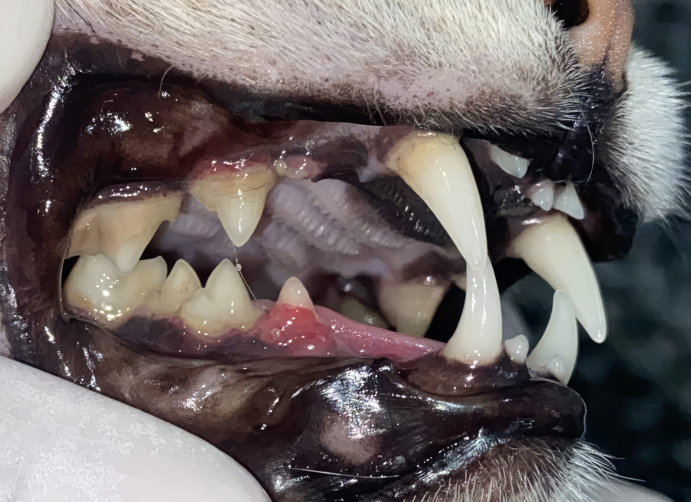 Imagen 1. Paciente felino con dientes supernumerarios y apiñamiento dentario, alteraciones anatómicas que favorecen la retención de biofilm dental y predisponen al desarrollo de enfermedad periodontal. En el segundo premolar mandibular se aprecia tejido de granulación compatible con una lesión de reabsorción dentaria felina (TR).