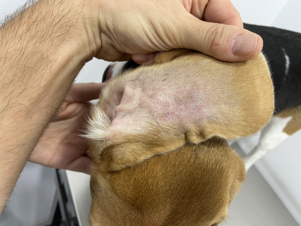 Imagen del pabellón auricular anterior derecho en la que apenas se observa la cicatriz de la incisión, pero sí un eritema moderado en la zona media de la oreja.