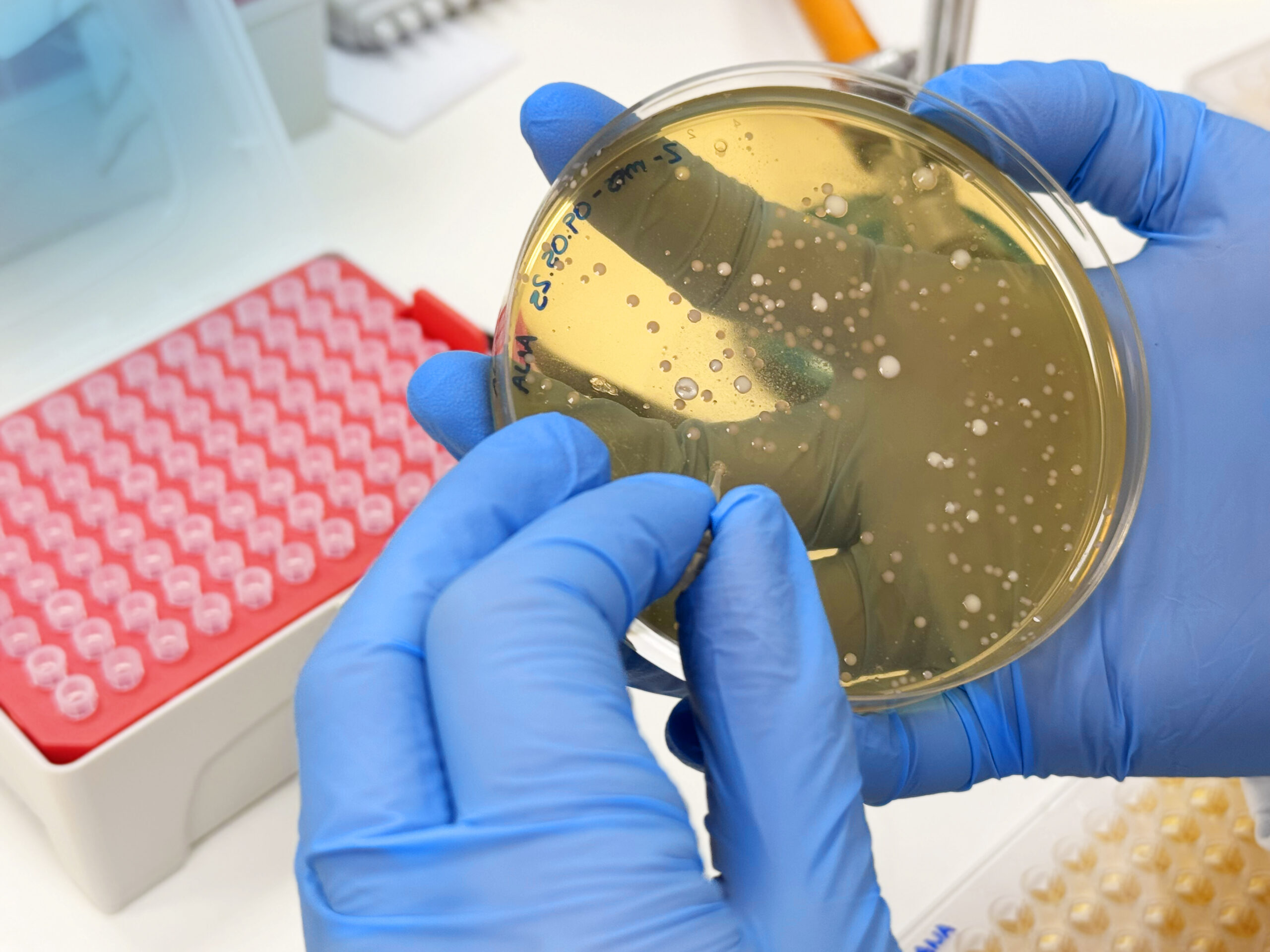Placa de petri con cultivo con bacterias en un laboratorio