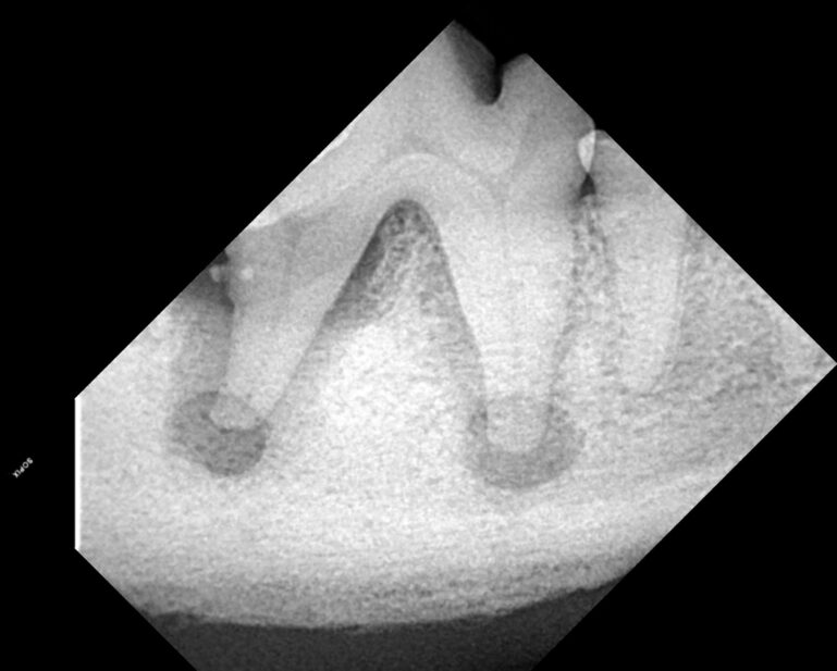 Uno de los mayores cambios en la odontología veterinaria es la incorporación de la radiología intraoral.