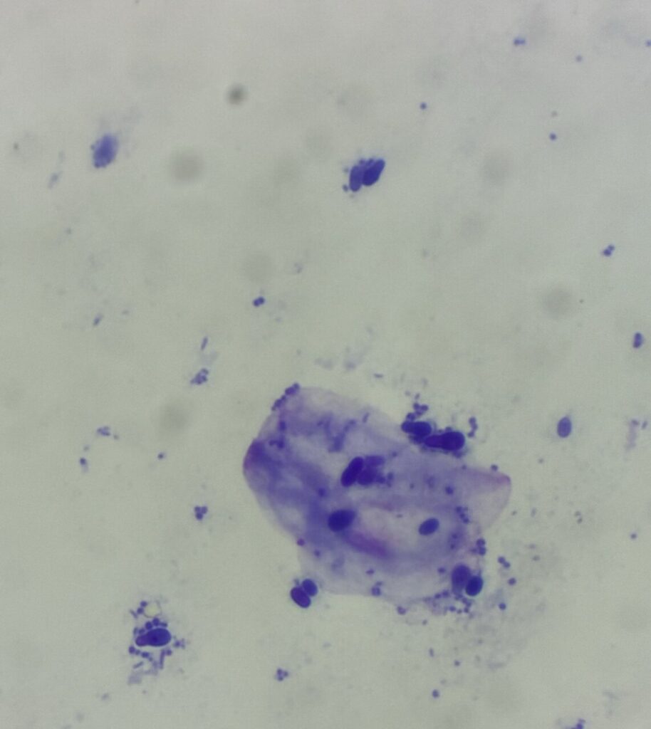 Citología cutánea mediante cinta adhesiva donde se observan bacterias cocoides y levaduras compatibles con Malassezia spp.