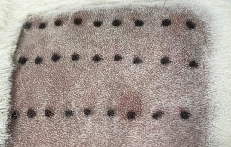 La prueba intradérmica (skin test) resultó positiva a diferentes alérgenos ambientales
